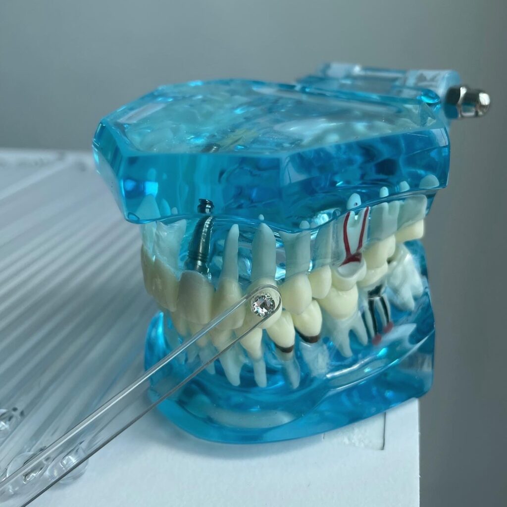 when booking an appointment, you can use these sticks to see what crystals will look like on teeth, blue plastic tooth model